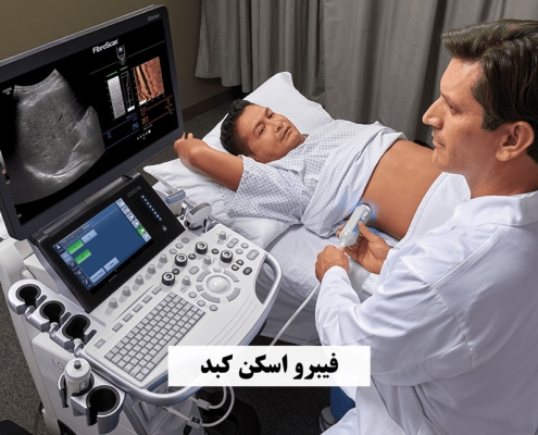 فیبرواسکن کبد