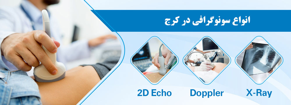 انواع سونوگرافی در کرج