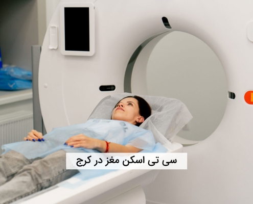 سی تی اسکن مغز در کرج