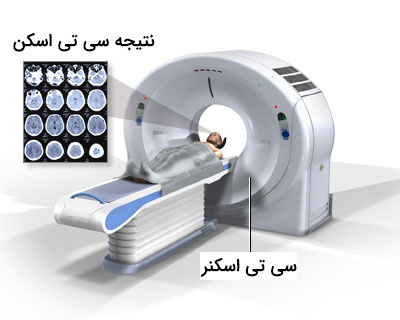 سی تی اسکن مغز چیست