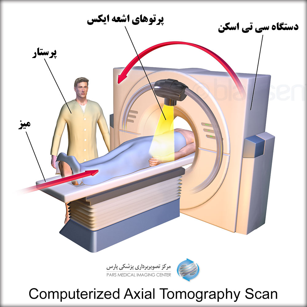 سی تی اسکن