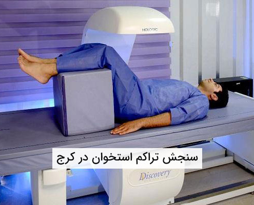 سنجش تراکم استخوان در کرج