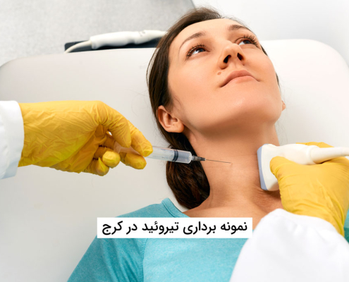 نمونه برداری تیروئید در کرج