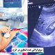 سونوگرافی غدد لنفاوی در کرج