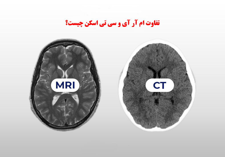 تفاوت ام آر آی و سی تی اسکن چیست؟