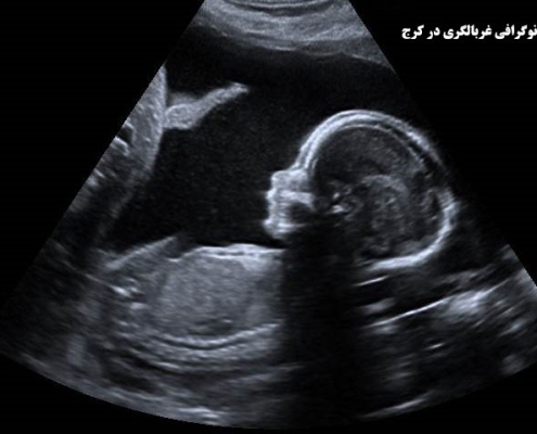 سونوگرافی غربالگری در کرج