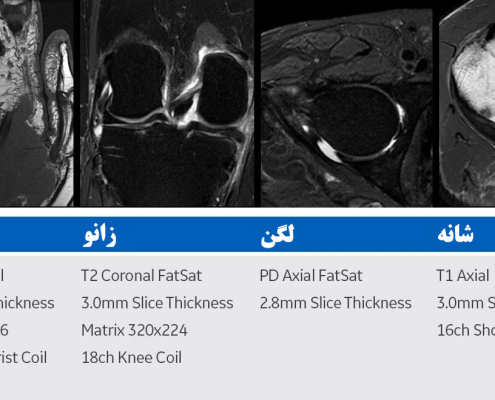 ام آر آی عضلانی ‌اسکلتی