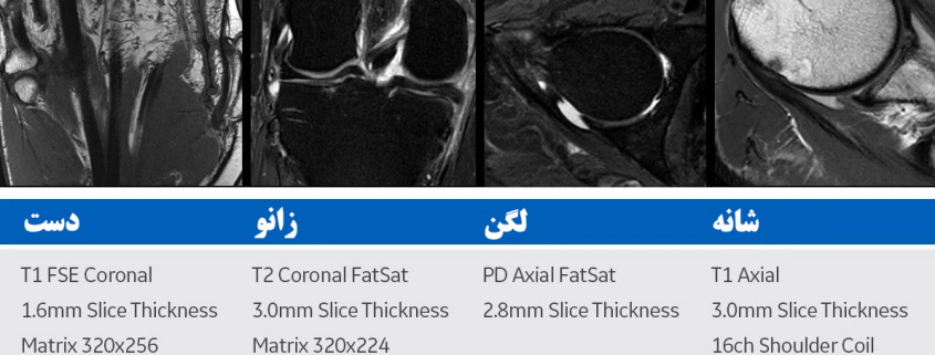 ام آر آی عضلانی اسکلتی