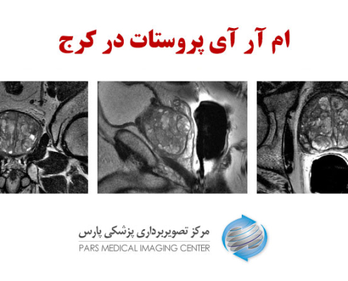 ام آر آی پروستات در کرج