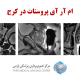 ام آر آی پروستات در کرج