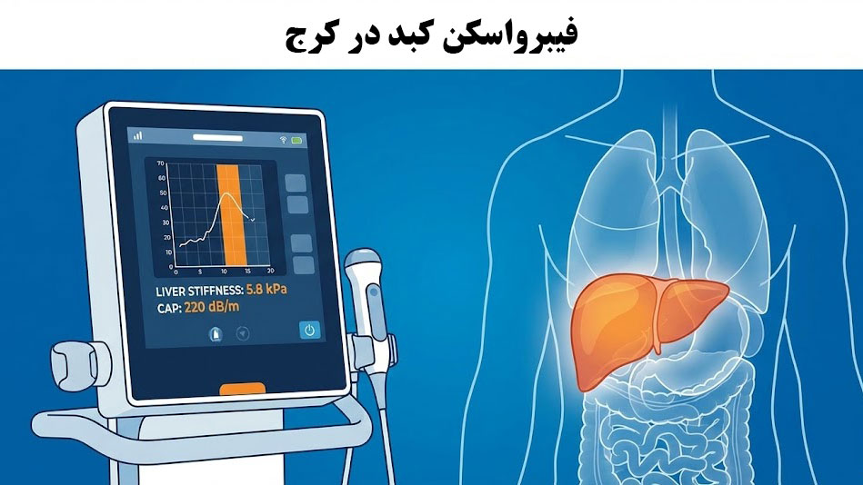 فیبرواسکن کبد در کرج فیبرواسکن کبد در کرج