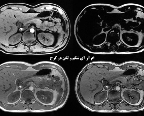ام آر آی شکم و لگن در کرج
