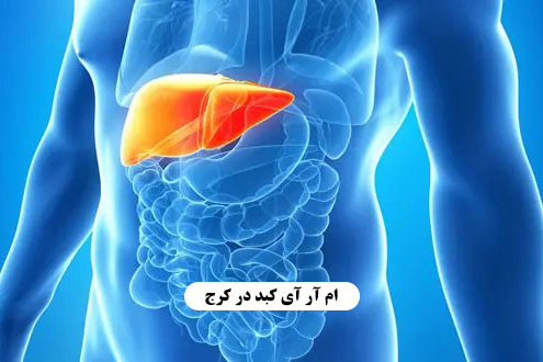 ام آر آی کبد در کرج