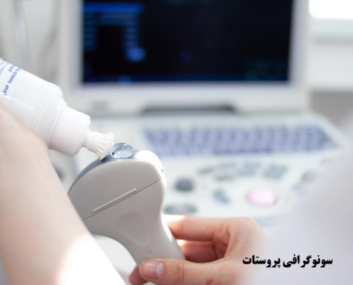 سونوگرافی پروستات در کرج