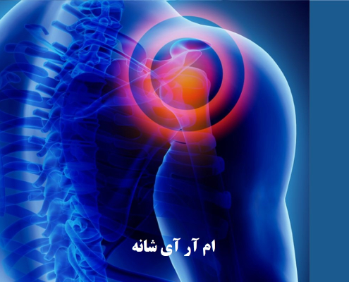ام آر آی شانه در کرج