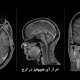 ام آر آی هیپوفیز در کرج