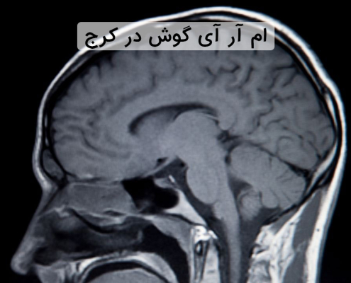 ام آر آی گوش در کرج
