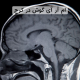 ام آر آی گوش در کرج