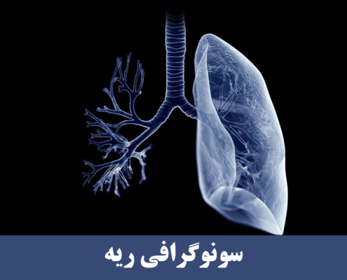 سونوگرافی ریه