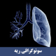 سونوگرافی ریه
