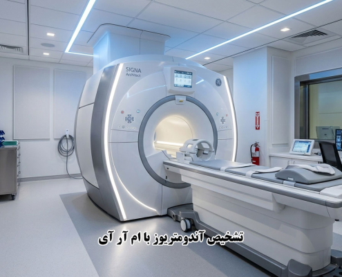 تشخیص آندومتریوز با ام آر آی