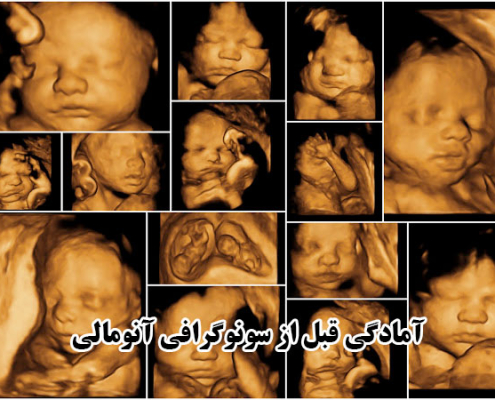 آمادگی قبل از سونوگرافی آنومالی