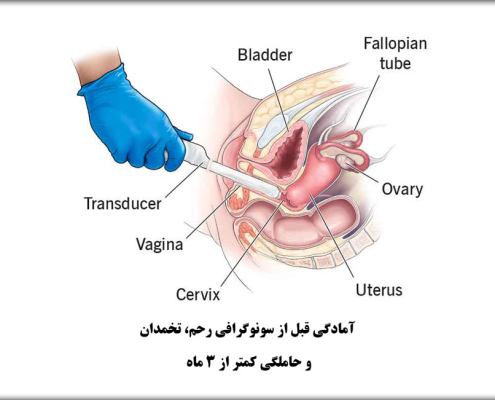 آمادگی قبل از سونوگرافی رحم، تخمدان و حاملگی کمتر از 3 ماه