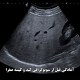 آمادگی قبل از سونوگرافی کبد و کیسه صفرا