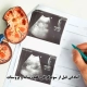 آمادگی قبل از سونوگرافی کلیه